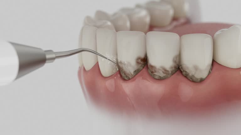 Trusted Tooth Extraction service in Prosper, TX - Dentist Open Now